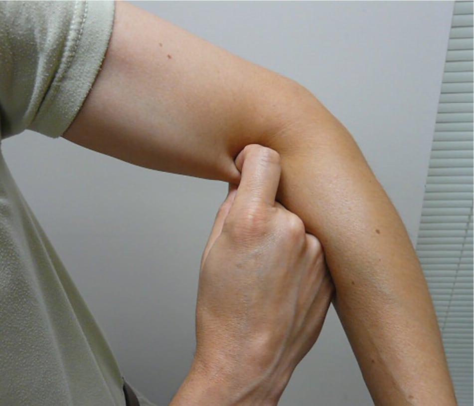 Hook Test for Tennis Elbow